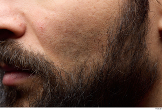 HD Face Skin Turgen cheek face skin pores skin texture…